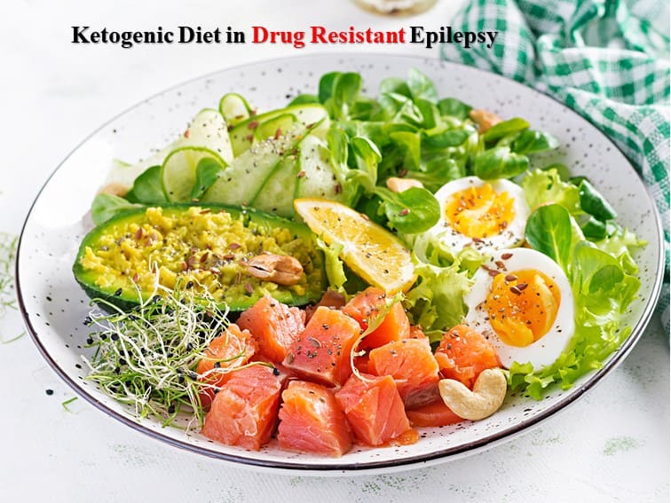 Ketogenic diet in epilepsy